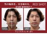 小顔×輪郭形成【RED SHOT】¥13500→¥9900