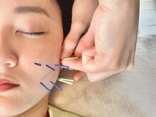 ハル(HALU)/辛い食いしばり・エラ張りに