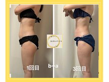 ひぺりかむ/月1回来店でリンパ流し