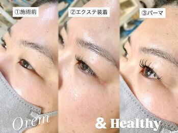 オルム(orem)/アンドヘルシー