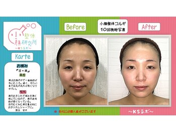 小顔整体研究所 KSラボ 鳴海店/比較写真6