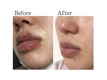 ハイケア グラン ギンザ(HYCARE GRAND GINZA)/日本ーの肌改善サロン実力/銀座