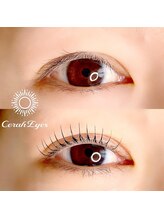 チュラアイズ(CerahEyes)/【お客様ビフォーアフター】