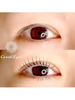 チュラアイズ(CerahEyes)/【お客様ビフォーアフター】