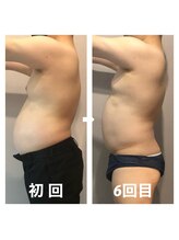 伊達男/フォースカッター事例