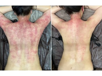 ブランシュムーニー(BRANCHE MOONY)/背中のシルエットがスッキリ！