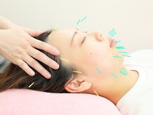鍼プラス 美肌屋 スズカサロン(鍼plus Suzuka salon)
