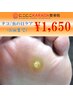 【足のメンテナンス】タコ・ウオノメケア（1cmまで）￥1,650