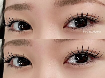 エクレ(eclat)の写真