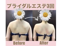 スワン 新栄店(SWAN)/他店より駆け込み花嫁様B→A