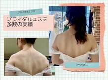 トータルエステサロン エステアンドメイク 錦糸町の雰囲気（ブライダル特化サロン/多数の実績/挙式直前駆け込みクーポンあり）