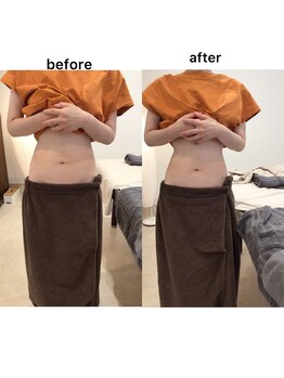 ジョワイユ(Joyeux)/腸の位置でお腹は変わる