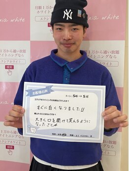 エクシアホワイトニング 町田店/お客様の口コミをご紹介☆