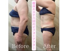 介正鍼灸整骨院 整体院 エフコープ大野城店の雰囲気（キャビ・ラジオ波・吸引・リンパマッサージで集中燃焼！！）