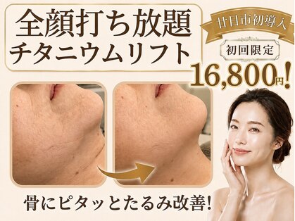 ルース(LUCE)の写真