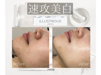 セレニテ(Serenite)/クリスティーナ イラストリアス