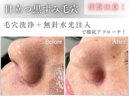 ドクターエイチ 梅田本店(Doctor.H)の写真
