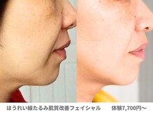 アンシャンテ 神戸元町店(Enchante)/肌質改善フェイシャル神戸元町