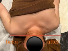 モアルポ 四日市(more repos)/初回体験のお客様のbefor＆after