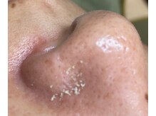 サイ(Sai)/詰まりがごっそり