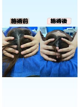 クオリア整骨院/小顔矯正・頭蓋骨矯正・不眠