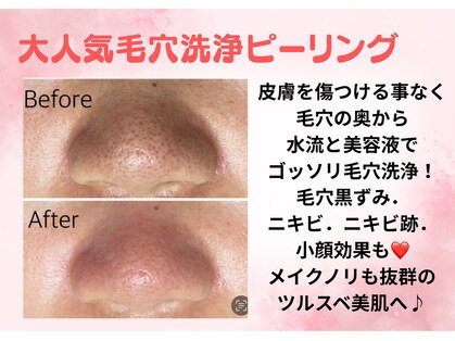 ルアナ(Ruana)の写真