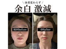 キュープ 鹿児島伊集院店(Qpu)/