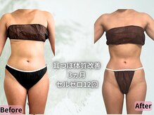 ポノ 茅ヶ崎(Pono.)/何をしても痩せない方探してます