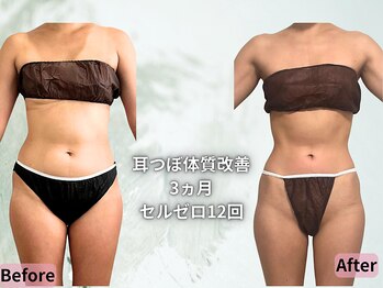 ポノ 茅ヶ崎(Pono.)/何をしても痩せない方探してます