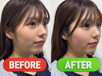 ヘッドミントVIP 稲毛店の写真/ガチガチ頭皮と顔のむくみを徹底ケア！頭からグッと引き上げる小顔アプローチでスッキリフェイスラインへ♪