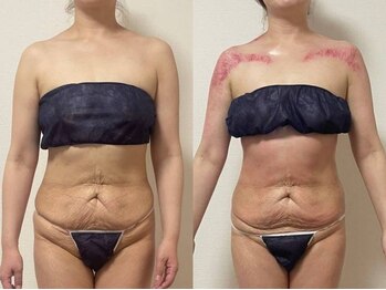 エパニ(epani)の写真/【都度払いOK】勧誘なしで気軽に通える痩身サロン。初めての方や自分のペースで無理なく続けたい方へ。