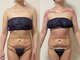 エパニ(epani)の写真/【都度払いOK】勧誘なしで気軽に通える痩身サロン。初めての方や自分のペースで無理なく続けたい方へ。