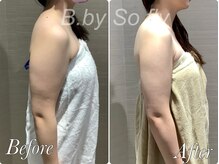 ビードット バイ ソーフライ(B.by So fly)/痩せにくい二の腕も、スッキリ♪