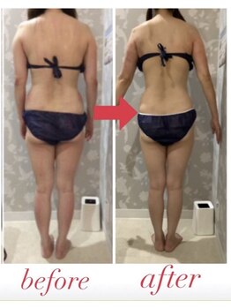 カラット(CARAT)/お客様のビフォーアフター一例