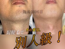 イーラディン(E-RADIN)の雰囲気（効果重視で痛みにも優しい機械を使用しております！）
