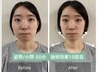 ＼大満足のお声多数／顔の歪み&大きさ改善+骨盤矯正+小顔矯正¥15,900→¥3,500