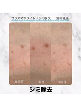 エクラ 六本木(eclat)/プラズマホワイト