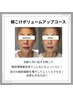 9月限定【部分】頬こけボリュームアップコース
