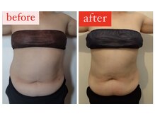 シェイプアップサロン/【Before＆After】