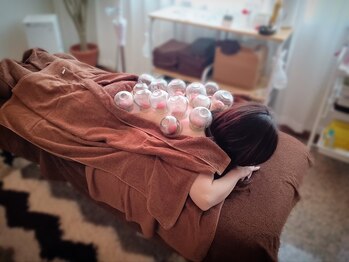 はりキュア(はりCure)/吸い玉療法（留罐）