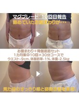 メディカルサロン フィオレ(fiore)/MAG BLADE骨盤底筋＆お腹集中