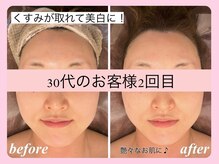 美人バスト 表参道店の雰囲気（お顔のお悩みも当店で解決★/小顔/美白/シミケア/リフトアップ）