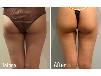 ルナグランデ 心斎橋店(Luna grande.)/内ももスッキリ