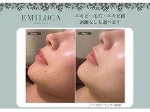 エミルカ 鹿児島店(EMILUCA)