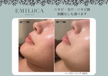 エミルカ 鹿児島店(EMILUCA)
