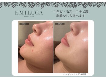 エミルカ 鹿児島店(EMILUCA)