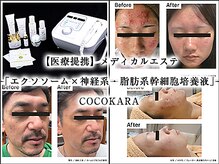 ココカラ(COCOKARA)