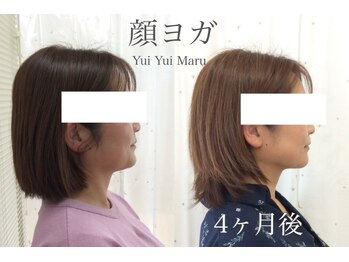 ユイユイマール(Yui Yui Maru)/フェイスラインすっきり♪