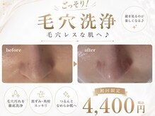 ソラ(Sola)