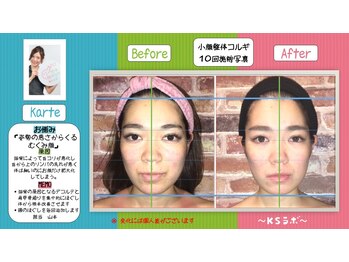 小顔整体研究所 KSラボ 鳴海店/比較写真7